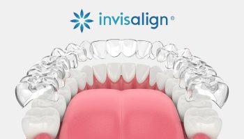 How Invisalign Treatment Enhances Overall Smile Aesthetics?
